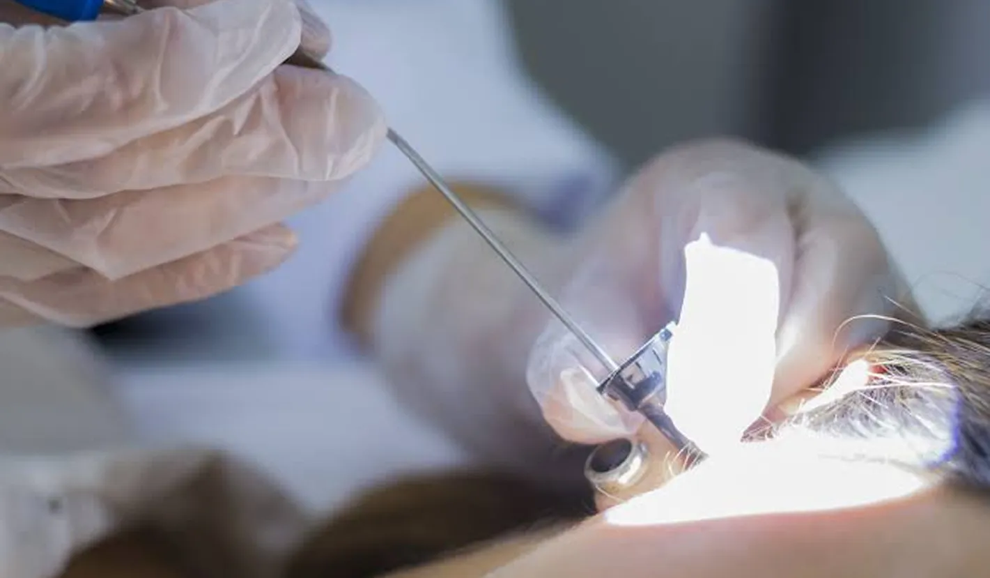 Procedimiento de rinoplastia en quirófano